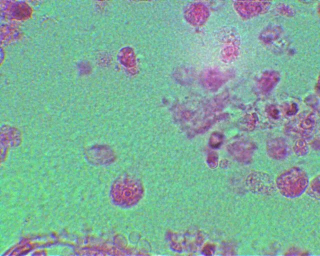 Naegleria fowleri