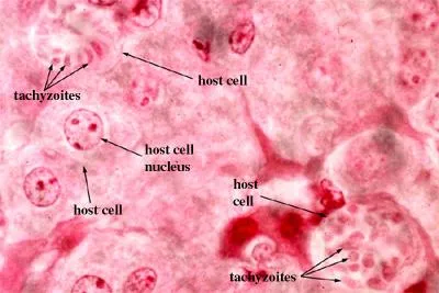 Toxoplazma gondii
